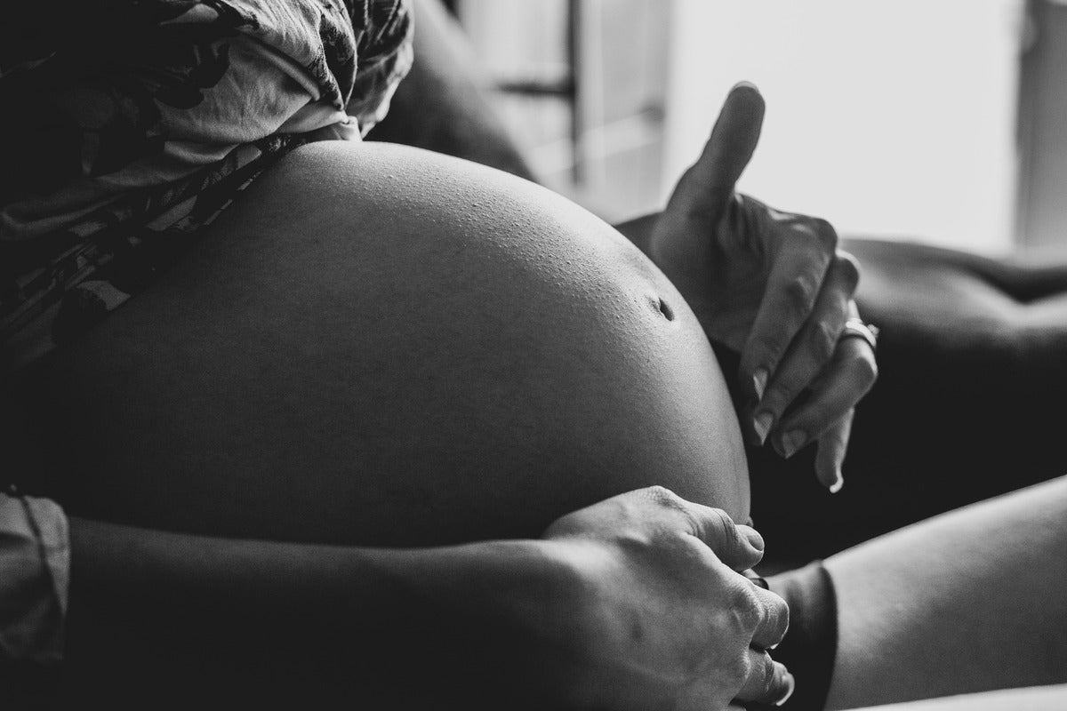Hair loss in women after childbirth (postpartum alopecia or postpartum telogen effluvium)