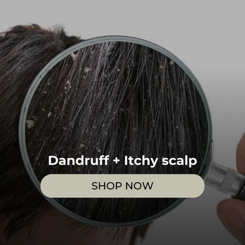 Dandruff + Itchy Skin and Scalp